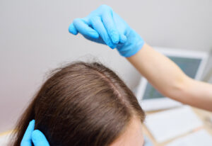 hair follicle drug test specialist collecting hair sample